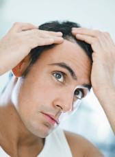Почему выпадают волосы | Лечение облысения в СМ-Косметология