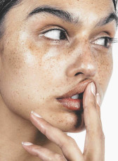 Как избавиться от пигментных пятен на лице и других частях тела?