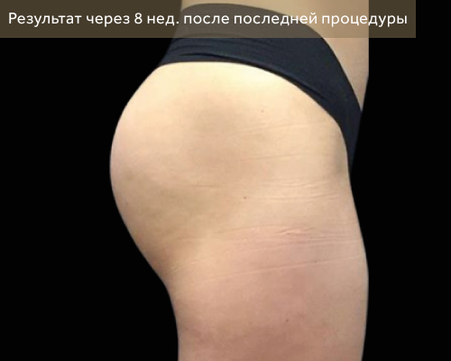 1 после.png