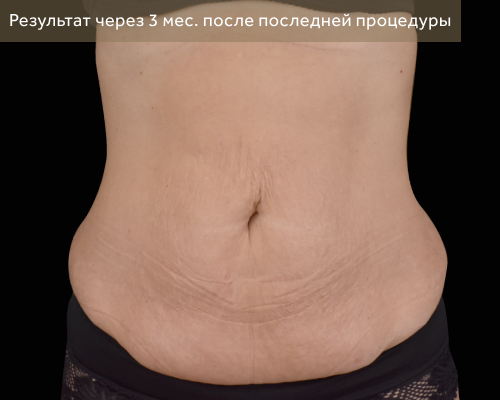 1 после.png