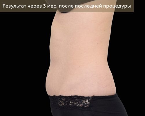 1 после.png