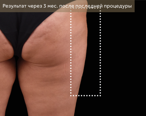 1 после.png