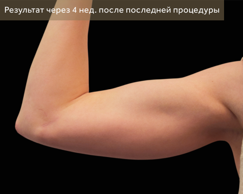 1 после.png