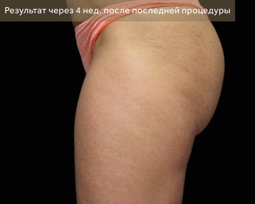 1 после.png